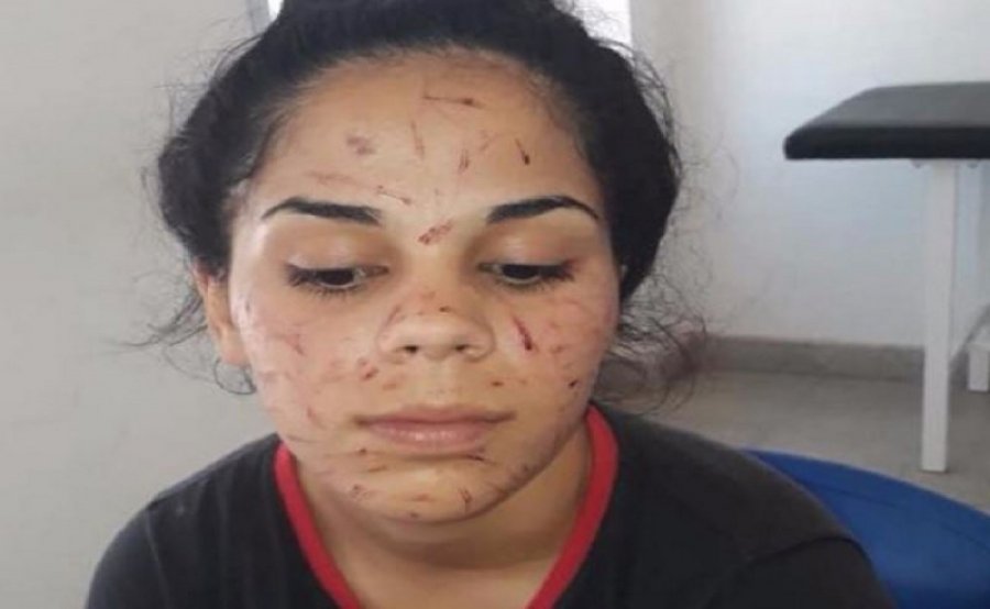Violencia