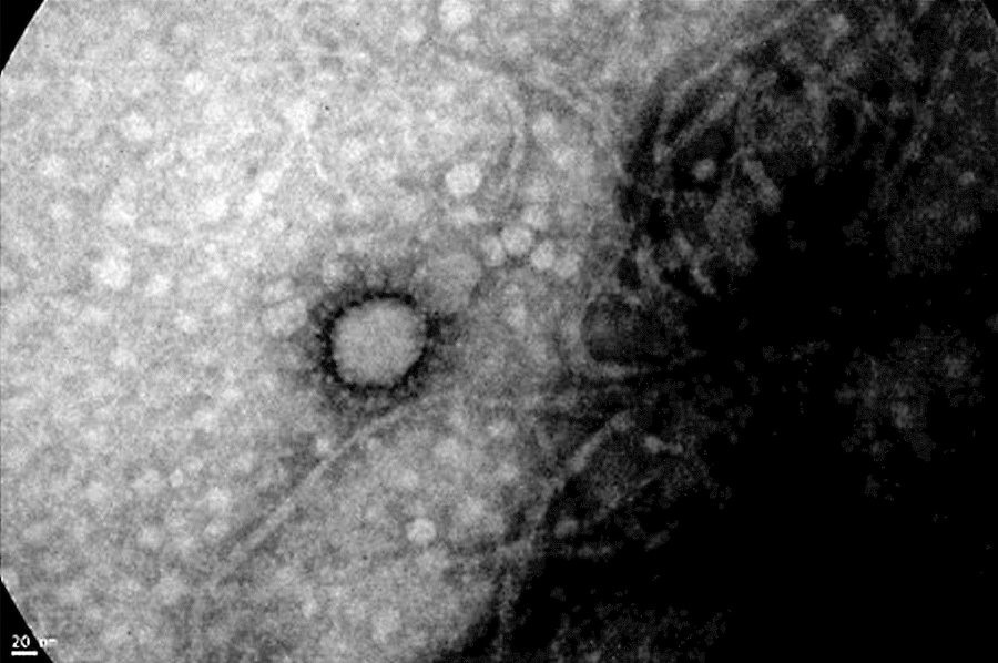 MICROSCOPICA. Imagen lograda por cient&iacute;ficos del Instituto Malbr&aacute;n y del Conicet.