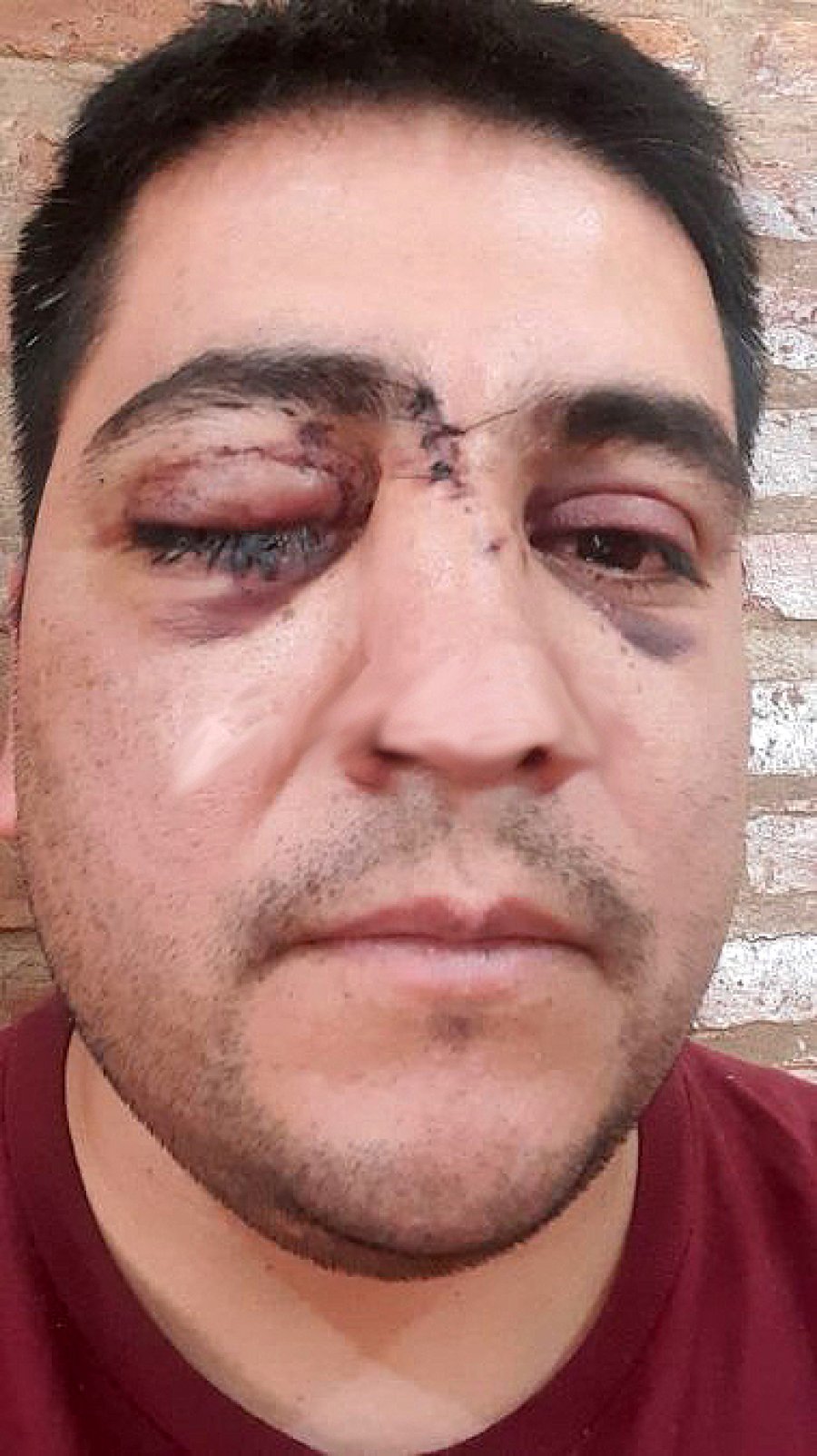 FOTO AIRE DE SANTA FE OFICIAL DANIEL CAPDEVILLA. Perdi&oacute; la visi&oacute;n de un ojo en la barbarie de Josefina.