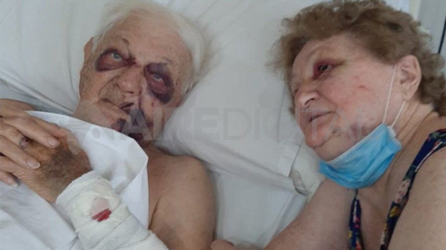 IMAGEN INTERNET REMIGIO Y ODILMA. Muestran las secuelas de la golpiza.