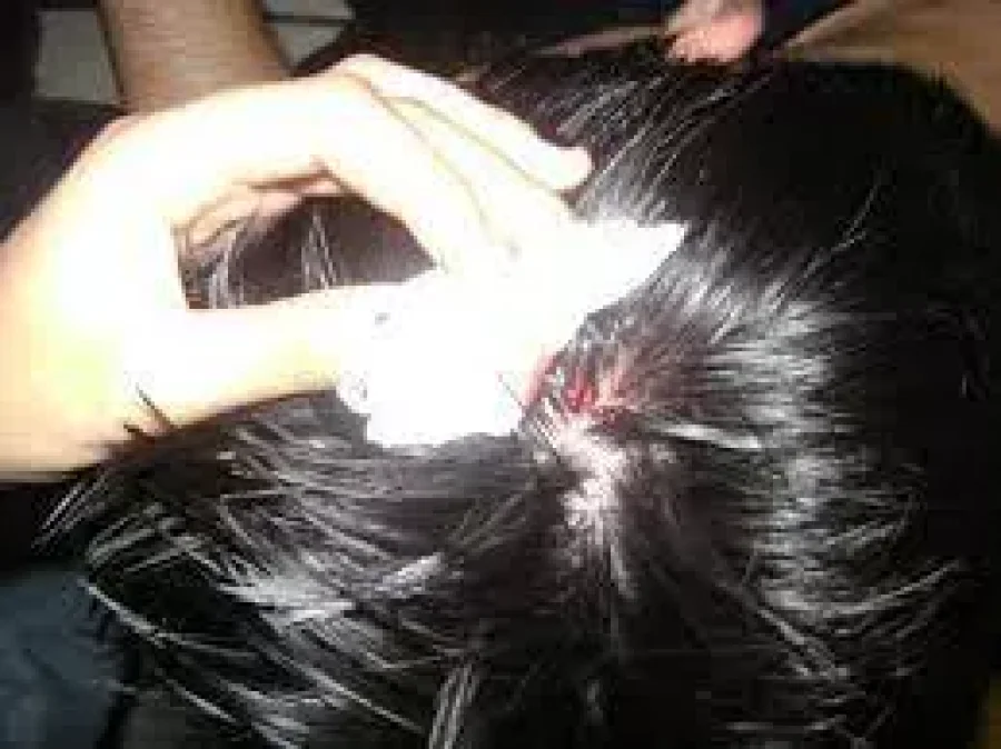 IMAGEN ARCHIVO. LESIONADO. Un fronterense  fue golpeado con un palo en su cabeza.