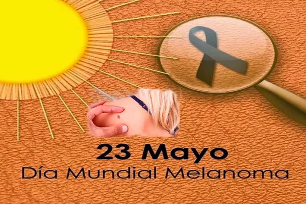 Día Mundial Contra El Melanoma Diario La Opinión De Rafaela