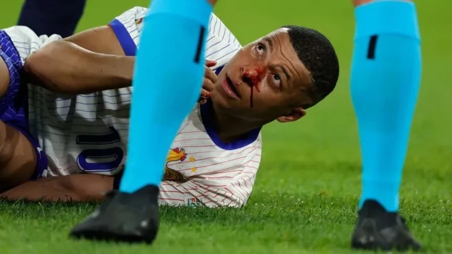 EN EL SUELO./ As&iacute; se ve&iacute;a el jugador franc&eacute;s.