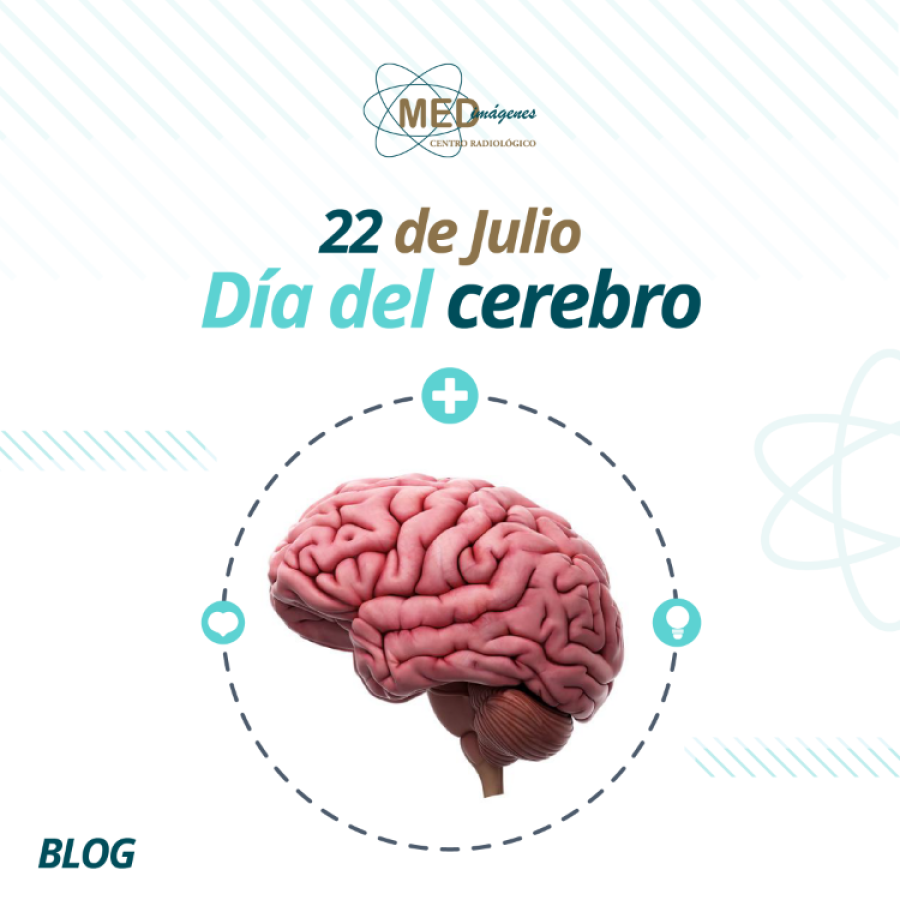 Las enfermedades cerebrales se diagnostican mediante una evaluaci&oacute;n exhaustiva.
