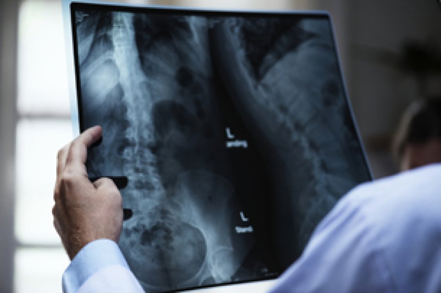 La radiolog&iacute;a es una estupenda herramienta para la medicina.