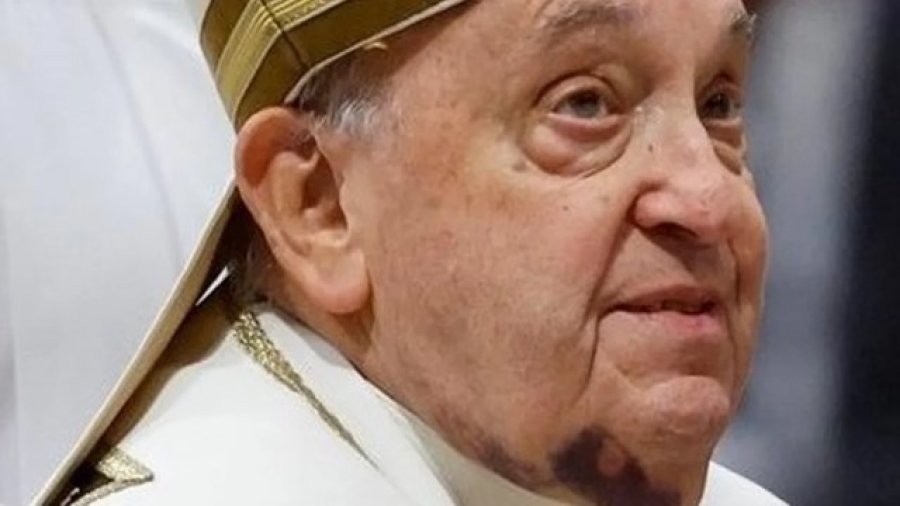 SIGUE INTERNADO. El l&iacute;der de la iglesia cat&oacute;lica permanece en estado cr&iacute;tico y preocupa su insuficiencia renal.
