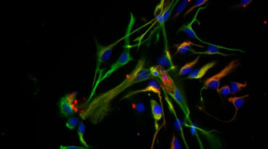 Neuronas y astrocitos: imagen de microscop&iacute;a de fluorescencia.