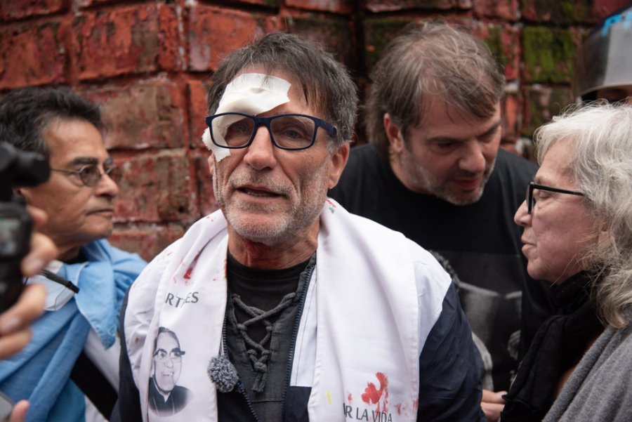 El Padre Olveira sufri&oacute; una herida durante la represi&oacute;n a la marcha de jubilados y organizaciones pol&iacute;ticas y sociales.
