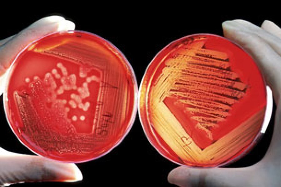 Los ecosistemas microbianos presentes en el organismo se localizan en el tracto gastrointestinal, genitourinario y respiratorio, boca, nariz, faringe y en la piel.