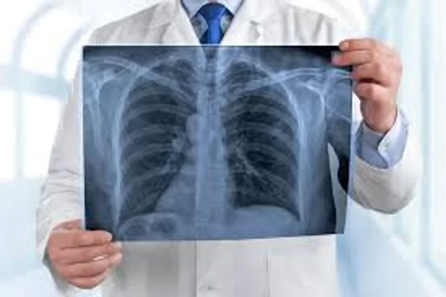 La visita al m&eacute;dico es fundamental para detectar a tiempo el c&aacute;ncer de pulm&oacute;n.