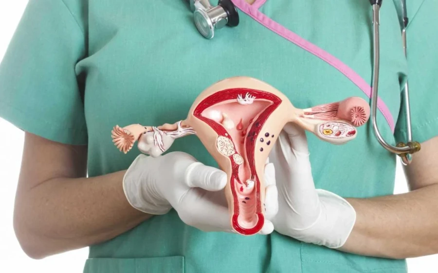 Cada a&ntilde;o se diagnostican cerca de 2.200 casos de c&aacute;ncer de ovario en Argentina.