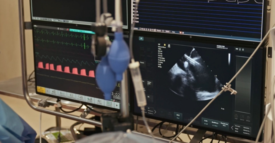 Pulse Select, tecnolog&iacute;a de innovaci&oacute;n cardiovascular.